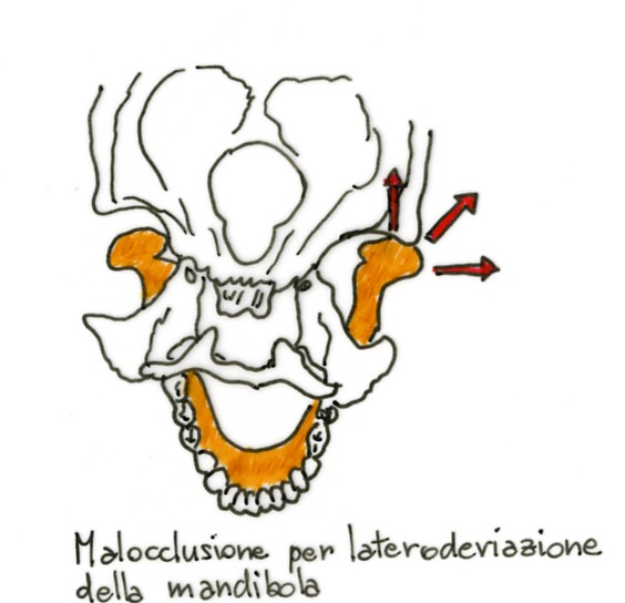 Temporo_Mandibolare2