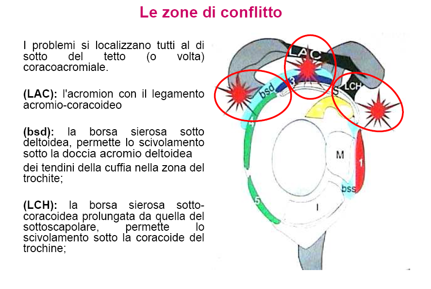 Zone Conflitto Spalla