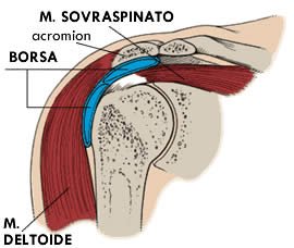 borsite-spalla