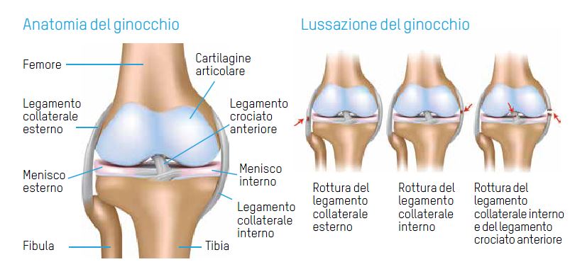 lesione collaterali