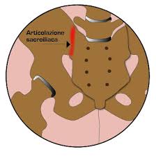 sacroileite3